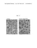 SIRTUIN INDUCER, TISSUE REPAIRING AGENT, HEPATOCYTE GROWTH FACTOR INDUCER,     TISSUE HOMEOSTASIS MAINTENANCE AGENT, AND TLR4 AGONIST, HAVING HYALURONIC     ACID FRAGMENT AS ACTIVE INGREDIENT diagram and image