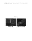 COMPOUNDS FOR THE TREATMENT OF PATHOLOGIES ASSOCIATED WITH AGING AND     DEGENERATIVE DISORDERS diagram and image