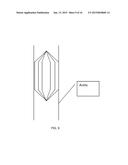 ENDOVASCULAR VENTRICULAR ASSIST DEVICE, USING THE MATHEMATICAL OBJECTIVE &     PRINCIPAL OF SUPERPOSITION diagram and image