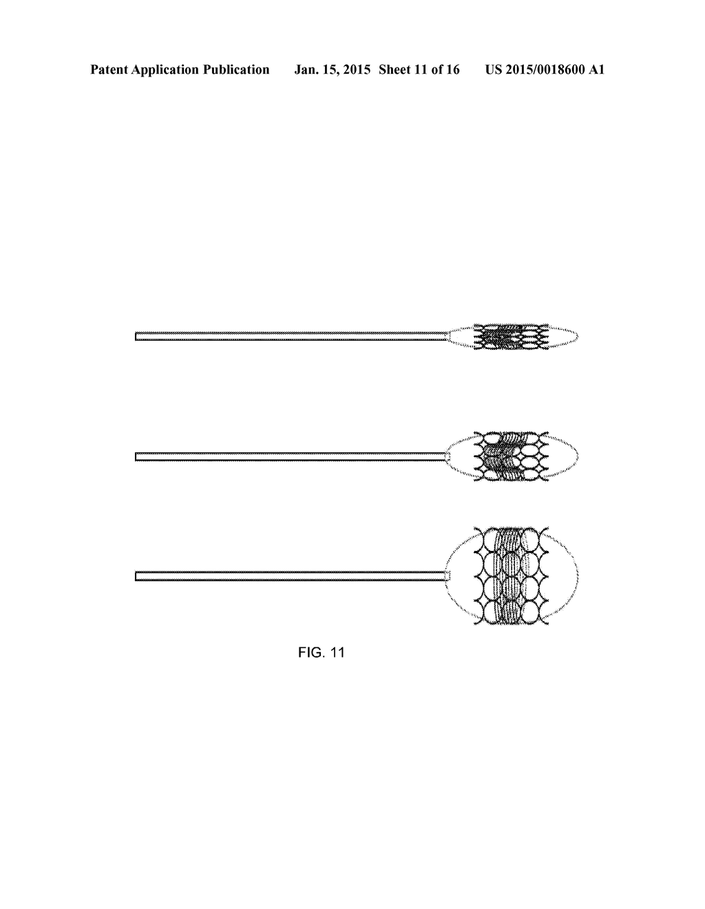 ENDOVASCULAR VENTRICULAR ASSIST DEVICE, USING THE MATHEMATICAL OBJECTIVE &     PRINCIPAL OF SUPERPOSITION - diagram, schematic, and image 12