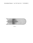 ENDOVASCULAR VENTRICULAR ASSIST DEVICE, USING THE MATHEMATICAL OBJECTIVE &     PRINCIPAL OF SUPERPOSITION diagram and image