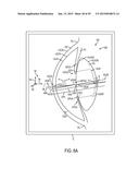 CORNEAL TOPOGRAPHY MEASUREMENT AND ALIGNMENT OF CORNEAL SURGICAL     PROCEDURES diagram and image