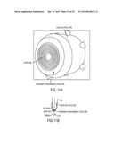 CORNEAL TOPOGRAPHY MEASUREMENT AND ALIGNMENT OF CORNEAL SURGICAL     PROCEDURES diagram and image