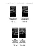 ULTRASONIC MEASURING DEVICE, ULTRASONIC IMAGE DEVICE, AND ULTRASONIC     MEASURING METHOD diagram and image