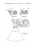 ACTUATOR FOR MOVING AN ULTRASOUND PROBE diagram and image