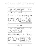 Defibrillator Display diagram and image