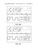 Defibrillator Display diagram and image