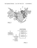 MODEL BASED RECONSTRUCTION OF THE HEART FROM SPARSE SAMPLES diagram and image