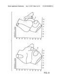 MODEL BASED RECONSTRUCTION OF THE HEART FROM SPARSE SAMPLES diagram and image