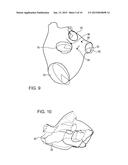 MODEL BASED RECONSTRUCTION OF THE HEART FROM SPARSE SAMPLES diagram and image