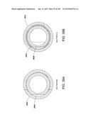 ENDOSCOPE INCLUDING AN TORQUE GENERATION COMPONENT OR TORQUE DELIVERY     COMPONENT DISPOSED WITHIN AN INSERTABLE PORTION OF THE ENDOSCOPE AND A     SURGICAL CUTTING ASSEMBLY INSERTABLE WITHIN THE ENDOSCOPE diagram and image