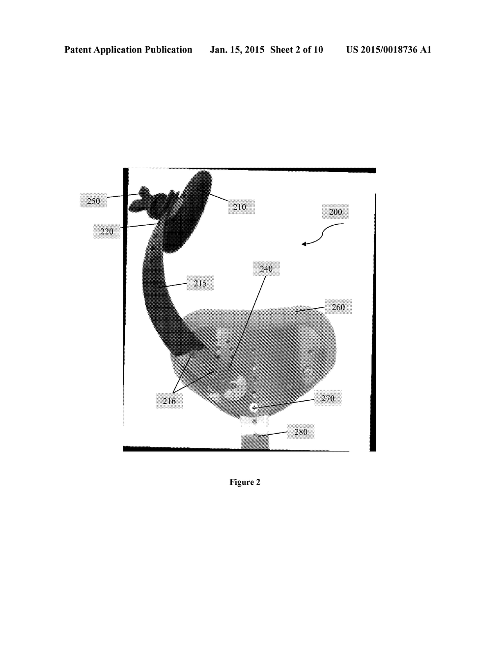 Scoliosis Brace - diagram, schematic, and image 03