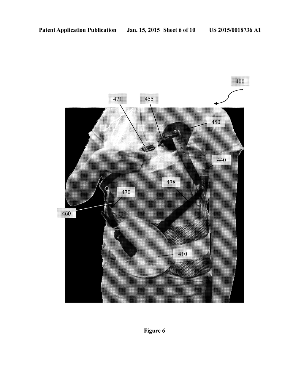 Scoliosis Brace - diagram, schematic, and image 07