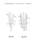 ANTI-FREE FLOW MECHANISM FOR ENTERAL FEEDING PUMPS diagram and image