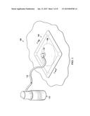 MANUALLY POWERED, REGULATED, NEGATIVE PRESSURE PUMP WITH ADAPTER FOR     EXTERNAL PRESSURE SOURCE diagram and image