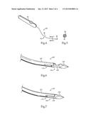 Suture Passer And Method Of Operating Same diagram and image