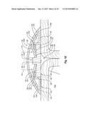 DETECTING LEAKAGE FROM AN INTERNAL SURGICAL SITE diagram and image