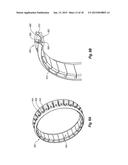 DETECTING LEAKAGE FROM AN INTERNAL SURGICAL SITE diagram and image