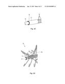 METHODS AND APPARATUS FOR TREATING PULMONARY EMBOLISM diagram and image