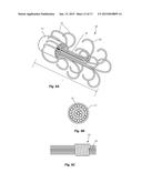 METHODS AND APPARATUS FOR TREATING PULMONARY EMBOLISM diagram and image