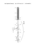 METHODS AND APPARATUS FOR TREATING PULMONARY EMBOLISM diagram and image