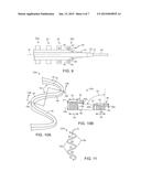 STENT WITH EASED CORNER FEATURE diagram and image