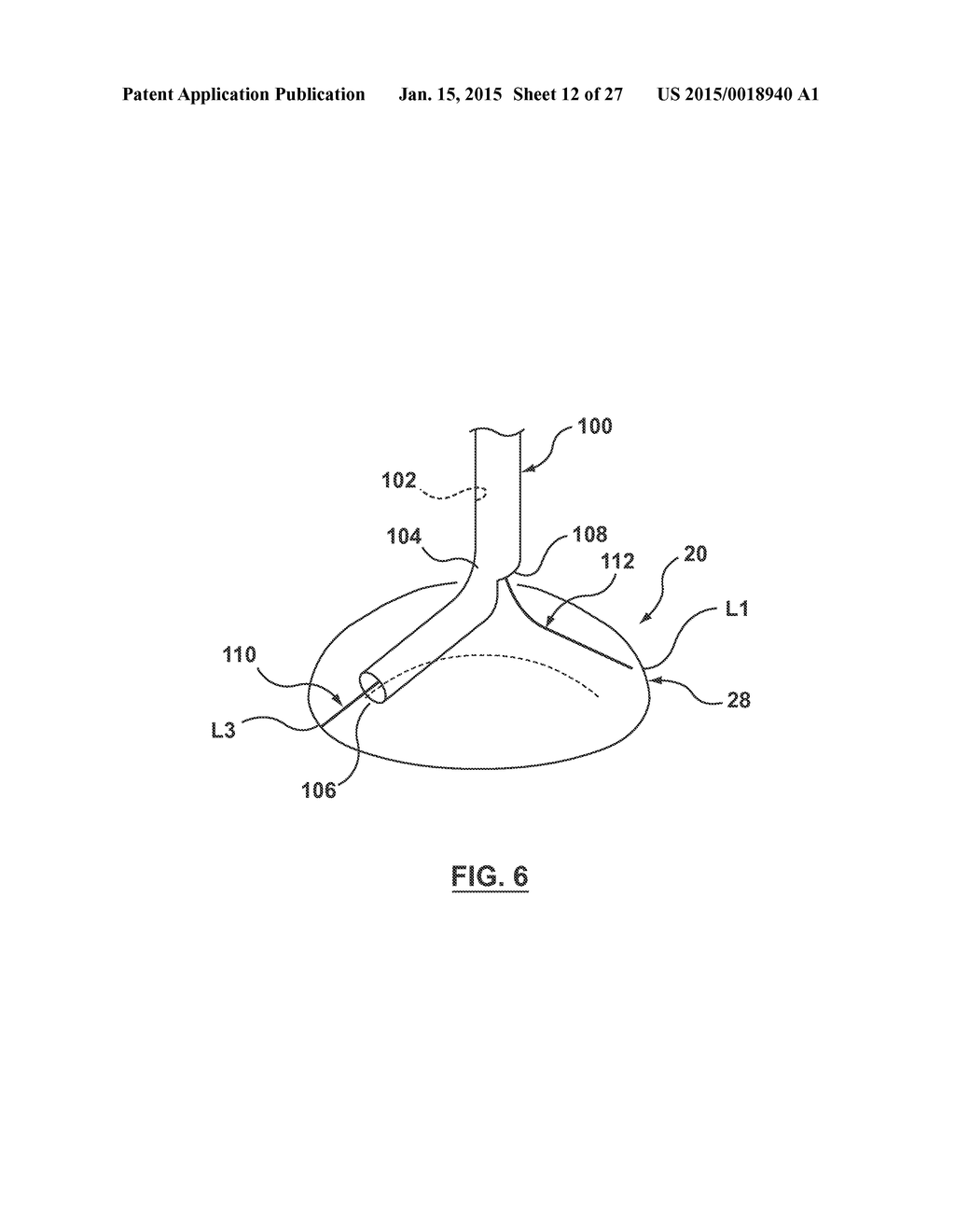 HELICAL COIL MITRAL VALVE ANNULOPLASTY SYSTEMS AND METHODS - diagram, schematic, and image 13