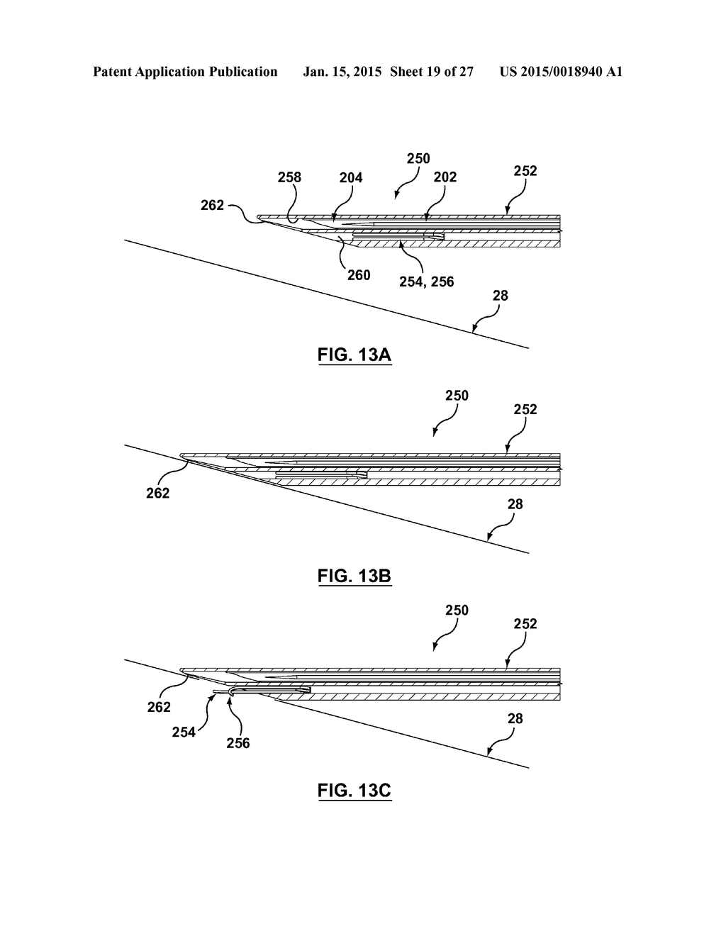 HELICAL COIL MITRAL VALVE ANNULOPLASTY SYSTEMS AND METHODS - diagram, schematic, and image 20