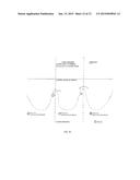 PERCUTANEOUS PROSTHETIC HEART VALVE diagram and image