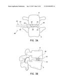 LATERAL INTERBODY FUSION DEVICES, SYSTEMS AND METHODS diagram and image