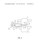 LATERAL INTERBODY FUSION DEVICES, SYSTEMS AND METHODS diagram and image