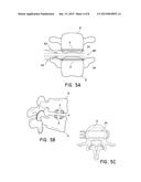 LATERAL INTERBODY FUSION DEVICES, SYSTEMS AND METHODS diagram and image