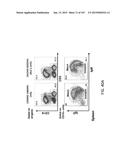 NON-HUMAN ANIMALS WITH MODIFIED IMMUNOGLOBULIN HEAVY CHAIN SEQUENCES diagram and image