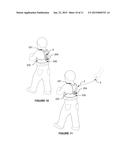 RESTRAINING DEVICE diagram and image