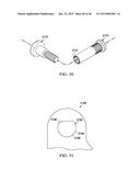 Wearable Device diagram and image