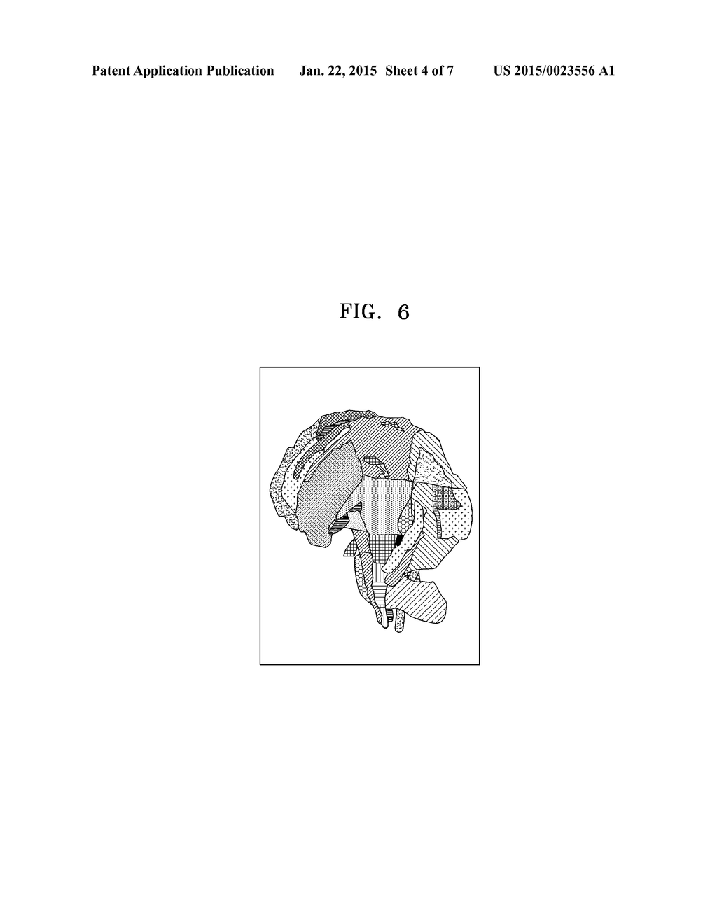 METHOD AND APPARATUS FOR SELECTING SEED AREA FOR TRACKING NERVE FIBERS IN     BRAIN - diagram, schematic, and image 05