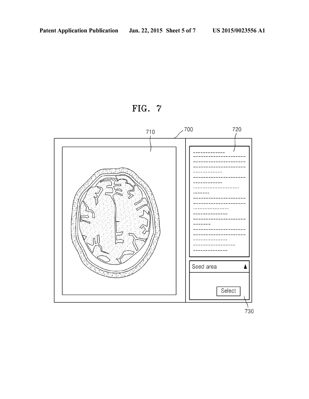 METHOD AND APPARATUS FOR SELECTING SEED AREA FOR TRACKING NERVE FIBERS IN     BRAIN - diagram, schematic, and image 06