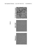 GRANULYSIN IN IMMUNOTHERAPY diagram and image