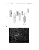 NOVEL COMPOSITIONS AND METHODS FOR PREVENTING OR TREATING CANCER     METASTASIS diagram and image