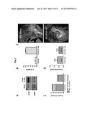 NOVEL COMPOSITIONS AND METHODS FOR PREVENTING OR TREATING CANCER     METASTASIS diagram and image