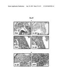 NOVEL COMPOSITIONS AND METHODS FOR PREVENTING OR TREATING CANCER     METASTASIS diagram and image