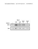 NOVEL COMPOSITIONS AND METHODS FOR PREVENTING OR TREATING CANCER     METASTASIS diagram and image