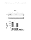 NOVEL COMPOSITIONS AND METHODS FOR PREVENTING OR TREATING CANCER     METASTASIS diagram and image