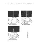 Treatment and Diagnosis of Melanoma diagram and image