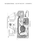 Treatment and Diagnosis of Melanoma diagram and image