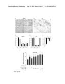 PAR-1 Activation by Metalloproteinase-1 (MMP-1) diagram and image