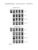 PAR-1 Activation by Metalloproteinase-1 (MMP-1) diagram and image