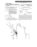 DEVICE AND A METHOD FOR DELIVERY OF A DENTAL COMPOSITION diagram and image