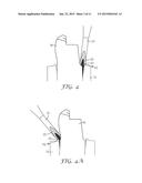 DEVICE AND A METHOD FOR DELIVERY OF A DENTAL COMPOSITION diagram and image