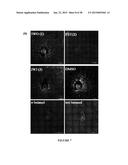 ANTIVIRAL THERAPIES WITH PHOSPHOLIPASE D INHIBITORS diagram and image